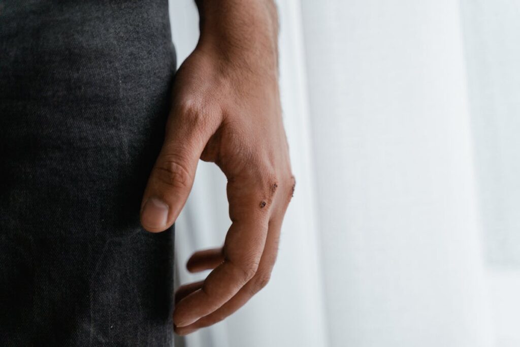 Close-Up Shot of Wound on a Person's Hand